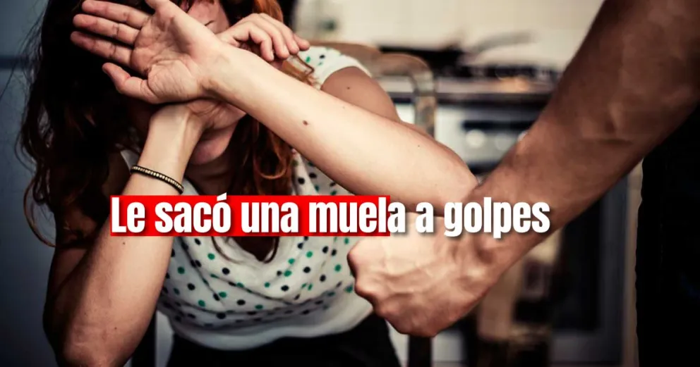 Fue condenado por golpear a su pareja ocasionándole la pérdida de una muela.