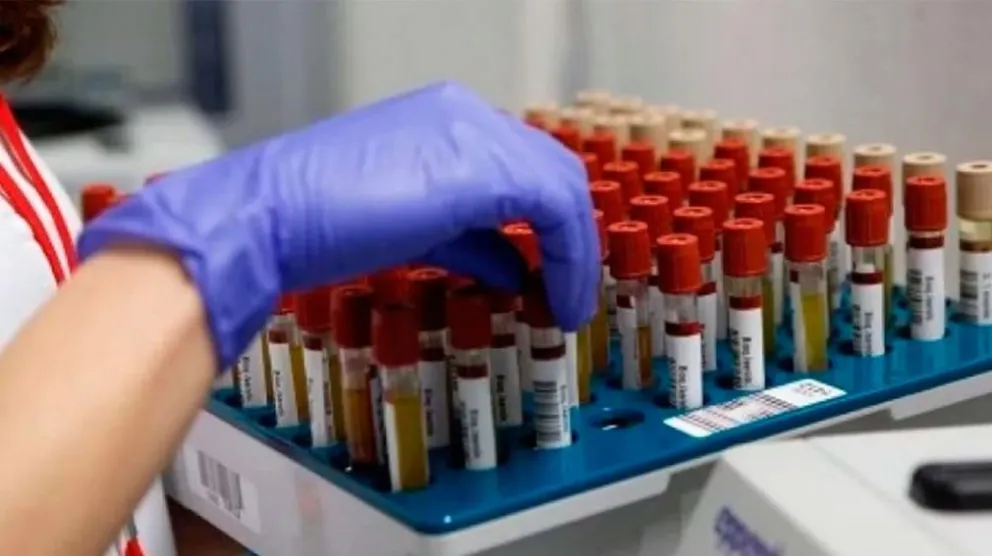 Los bioquímicos de San Juan comenzaron a cobrar un plus de $3.000 a usuarios de prepagas