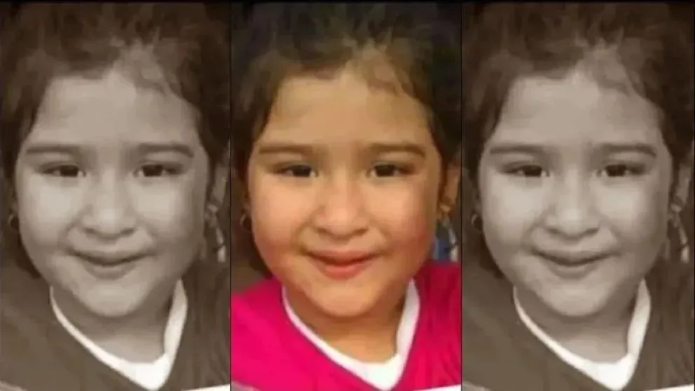 Un rayo de esperanza para Francesca: la nena que sufrió quemaduras en su cuerpo, recibió el alta médica