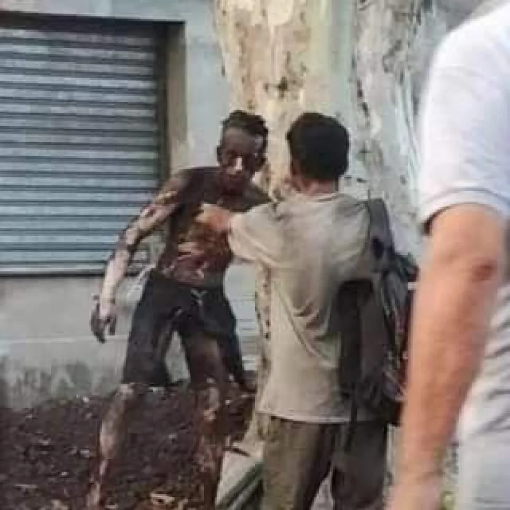 Intentó robar cables subterráneos y terminó con su cuerpo quemado