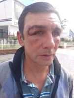 Familiares de un sanjuanino denuncian que policías lo patearon en la cabeza por estacionarse para dormir