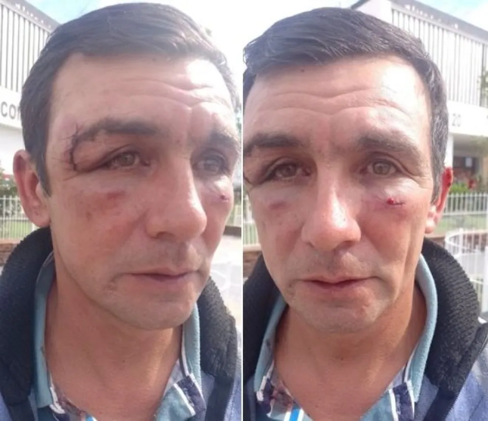 Tras la denuncia pública, investigarán a los policías acusados de golpear a un hombre en Angaco