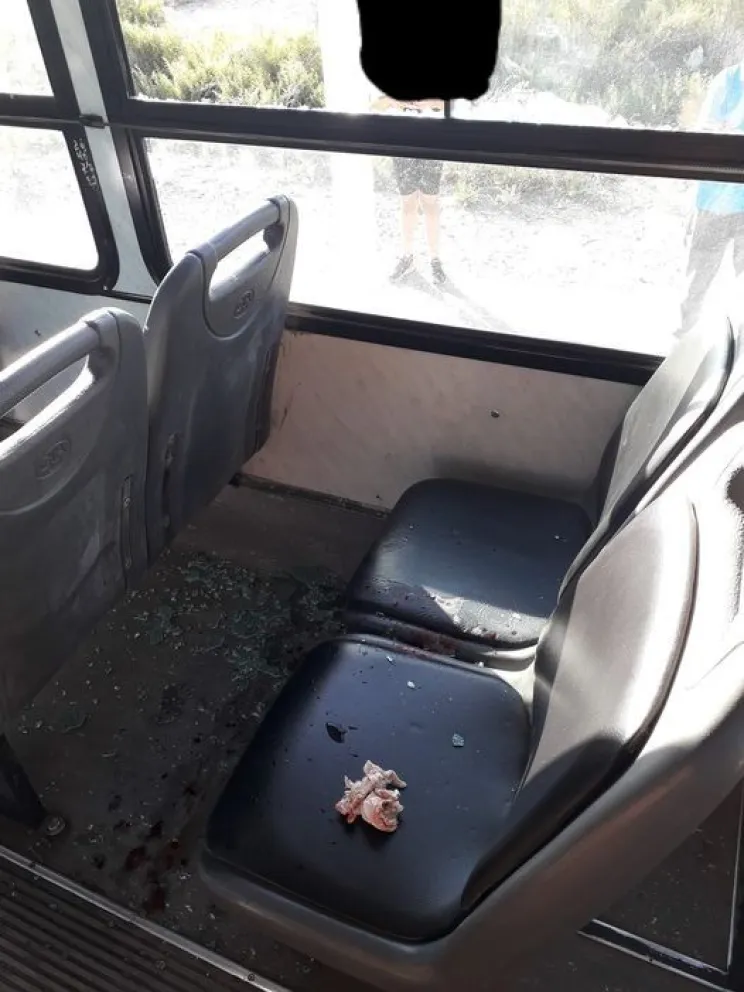 Una joven sanjuanina recibió una pedrada en el rostro mientras viajaba en colectivo.