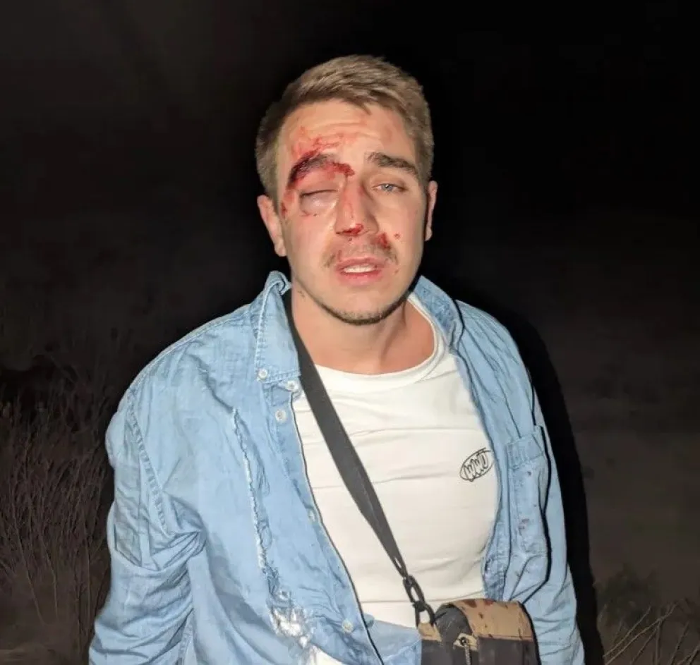 Desfigurado. Así quedó el rostro de uno de los turistas franceses, quien denunció que fue víctima de una golpiza.