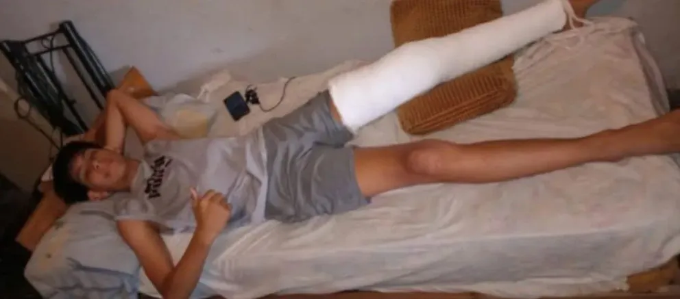 Gentileza: El bastón.