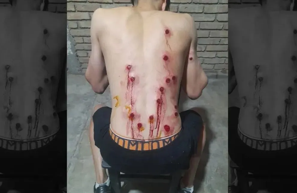 Detuvieron a dos policías sospechados de dispararle por la espalda a un joven. 