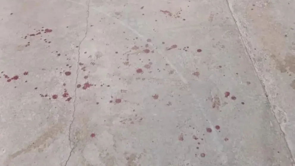 Fiesta de 15 terminó en caos: el padrastro y el tío de la cumpleañera se trenzaron a puntazos en pleno festejo (sangre de los protagonistas).