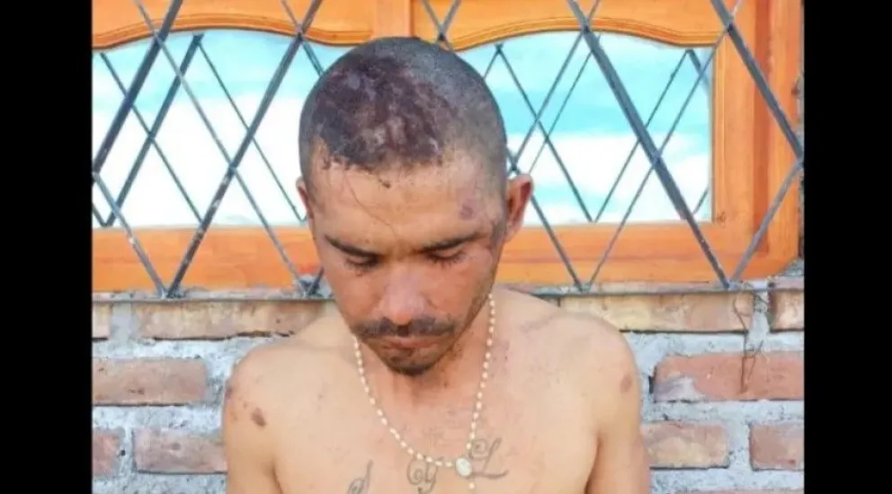 Víctima. Sebastián Carbajal y las heridas que padeció tras el brutal ataque. (Gentileza: Diario Popular San Juan)