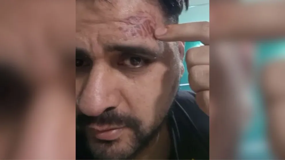 Secuelas. El productor, Marcos Ibarra, mostrando en el video que realizó sobre la agresión que dijo sufrió de parte de Ángel Torres.