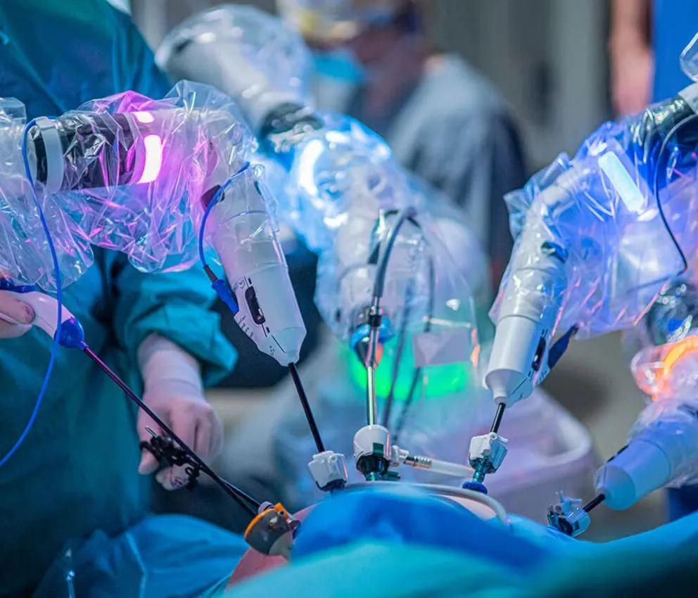 La inteligencia artificial transformó la cirugía robótica. 