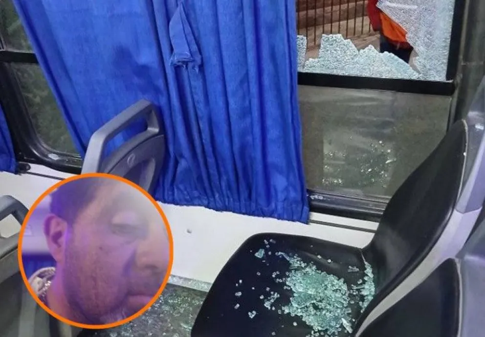 Gentileza: El bastón.