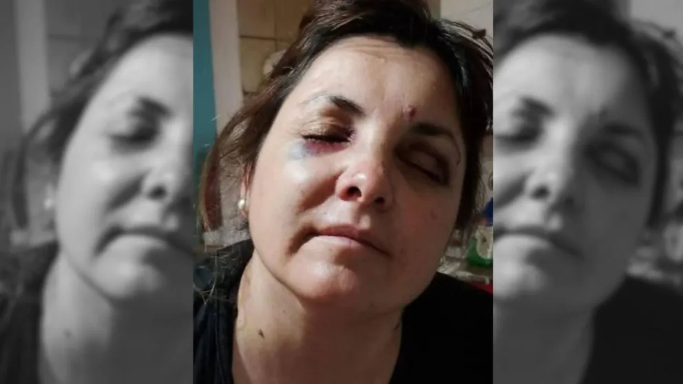 Melina, de 38 años.