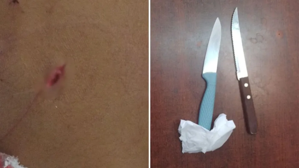 Según la Policía, la agresión fue cometida con el cuchillo de mango azul. 