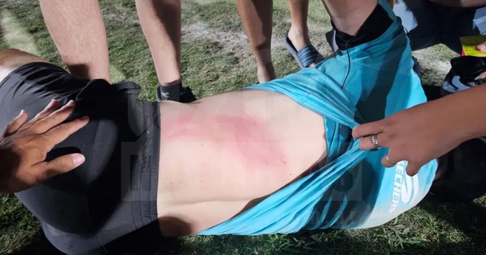 Así quedó el árbitro sanjuanino que fue agredido en un partido de la Liga Universitaria. Foto 0264Noticias.