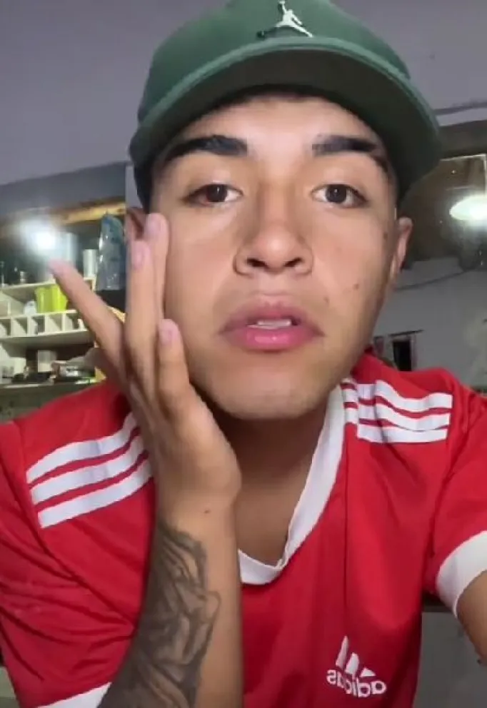 Las lastimaduras que sufrió el tiktoker Niño Marta en el intento de robo de su teléfono.