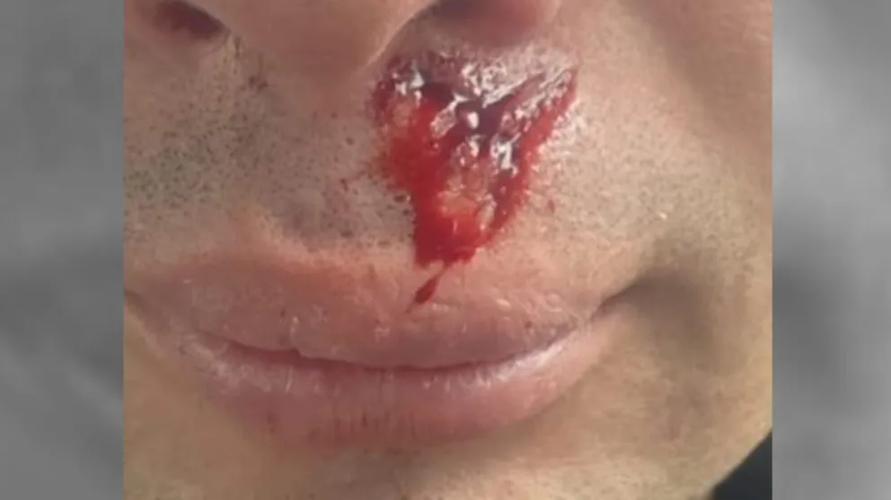 El rostro del policía agredido en inmediaciones del asentamiento Pedro Echague.