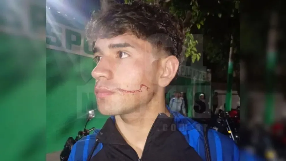 Ignacio Baraona, jugador afectado por los piedrazos.